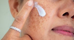 Krema za sunčanje za masnu kožu lica: Dermatolog otkriva na što trebate obratiti pažnju kod odabira