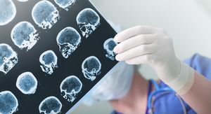 Liječnik pregledava EEG, ilustracija