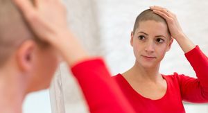 Kosa nakon kemoterapije: Kada počinje rasti i kako ubrzati?