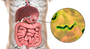 Helicobacter pylori: Skrivena bakterija koju ima svaki 3. čovjek – a može dovesti do raka