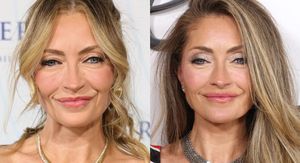 Rebecca Gayheart prije i poslije facelifta (zatezanja lica)