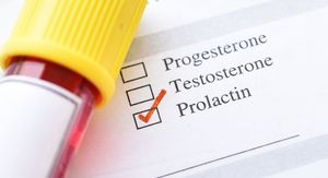 Hiperprolaktinemija: Simptomi koji ukazuju na hormonski disbalans i kako sniziti prolaktin