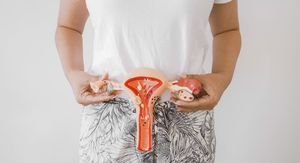 Znanstvenici otkrivaju: Ova jednostavna navika može sniziti testosteron kod žena s PCOS-om!