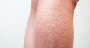 Kako ublažiti iritaciju kože nakon brijanja? Zaboravite na crvenilo uz ovih 6 jednostavnih trikova