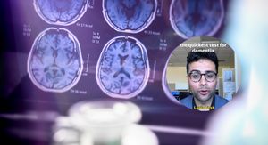 Snimke mozga i neurolog koji objašnjava test za demenciju