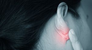 Dermatitis uha: Je li kriv nakit, slušalice ili gljivice? Evo kako prepoznati pravi uzrok!