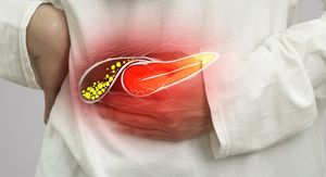 Što je dobro za žuč? Liječnici i nutricionisti slažu se oko ovih pravila