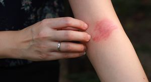 Ovih 5 znakova otkriva da vam crijeva nisu zdrava – većina ljudi ih potpuno ignorira