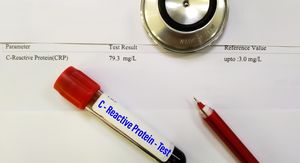 Hrana koja smanjuje CRP: Što jesti da upala prođe prirodnim putem?