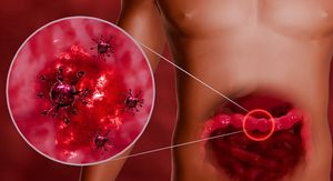 Hara nova varijanta norovirusa! Evo koji su simptomi