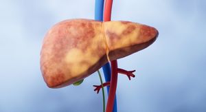 Mislite da imate “samo” masnu jetru? Evo zašto biste trebali provjeriti i srce