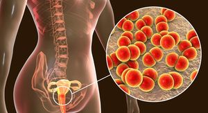 Nakon 40 godina – stiže prva nova terapija za gonoreju koja se pije u jednoj tableti!