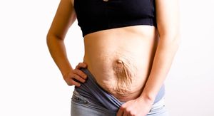 Vježbe za dijastazu: Zašto jačanje trbušnjaka često nije rješenje?