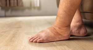 Više od 14 % ljudi ima ovu tihu bolest, a da to uopće ne zna – jeste li među njima?