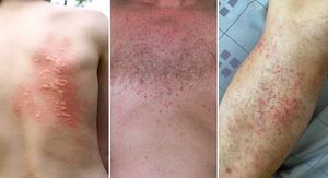 Nećete vjerovati što sve ljeti prijeti vašoj koži!