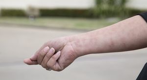 5 faktora koji mogu povećati rizik od leukemije – jedan mnogi i dalje podcjenjuju