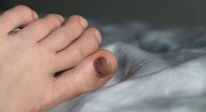 Boja noktiju na nogama: Što znače crni, žuti, zeleni, plavi i bijeli nokti?