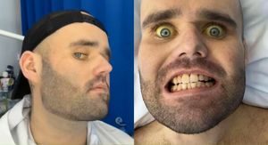 Sean Holland i njegovi simptomi alkoholizma