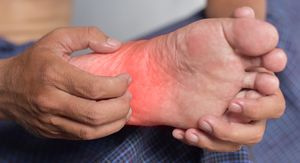 Svrbež ruku i stopala: 11 uzroka i kako prepoznati kada je vrijeme za liječnika