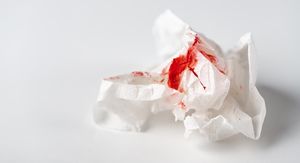 7 vrsta krvarenja koje nikad ne biste smjeli ignorirati