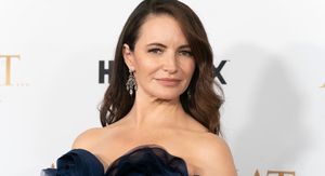 4 slavne žene koje su otvoreno progovorile o prorjeđivanju kose (jer se s tim problemom ne bore samo muškarci)