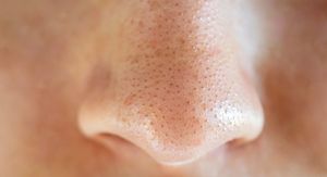 Ovo su najbolji i najgori načini za uklanjanje mitesera