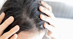 Kako spriječiti sijedenje kose? Evo što možete učiniti