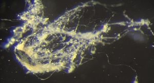 Candidatus Electrothrix yaqonensis