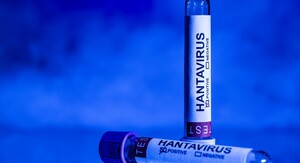 Hantavirus