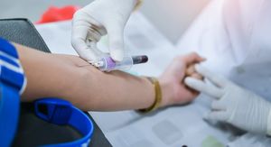 Ovaj “skriveni” kolesterol mnogi nikad ne provjere, a povećava rizik od moždanog udara!