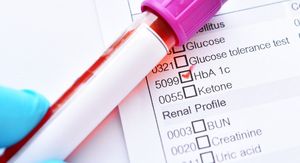 HbA1c: Ovaj broj može otkriti dijabetes i prije prvih simptoma