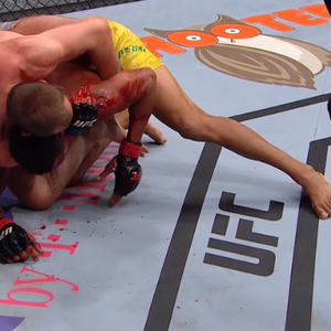 Krv curi iz čela Oliveire