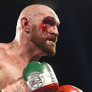 Tyson Fury (Foto: AFP)
