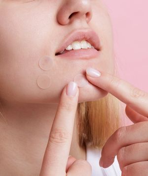 Pimple Patches