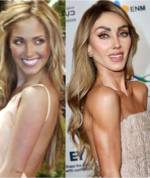 Anahi