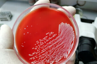 Bakterije u laboratoriju, ilustracija