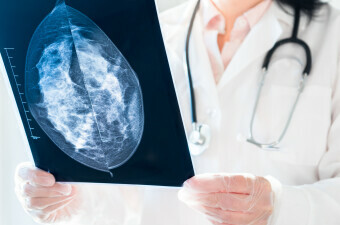 Pregled mamografske snimke, ilustracija