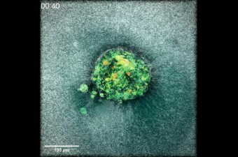 Implantacija embrija