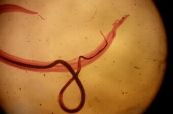 Schistosoma mansoni