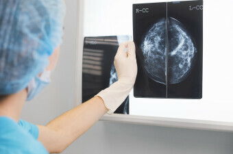 Mamogram