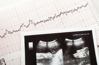 Ultrazvuk fetusa i kardiogram, ilustracija