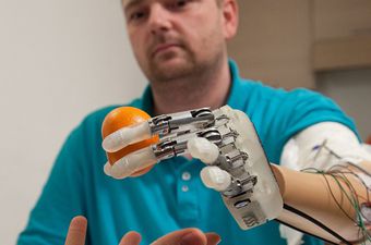 Tehnologija u službi medicine - Dancu omogućeno osjetilo dodira u ručnoj protezi