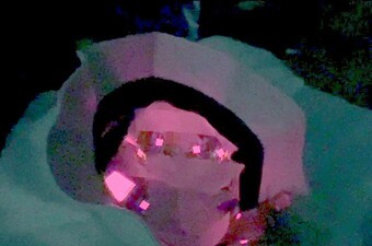 Kapa s OLED diodama za svjetlosnu terapiju vlasišta