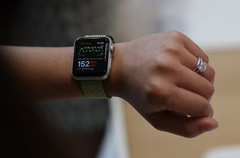 Apple Watch (Foto: AFP)