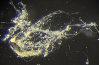 Candidatus Electrothrix yaqonensis