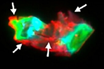 Mikrougrušak u krvi