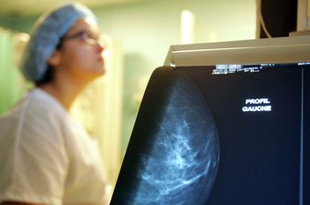 Mamogram (Foto: AFP)