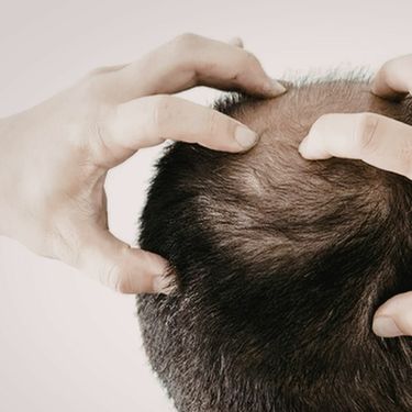 Ćelavi muškarac s rukama na glavi