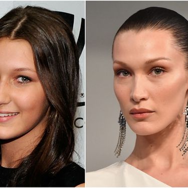 Nakon prvotnog negiranja, Bella Hadid dosad je priznala samo korekciju nosa