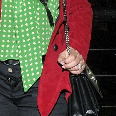 Glumica je na reviju došla s otkopčanim šlicom